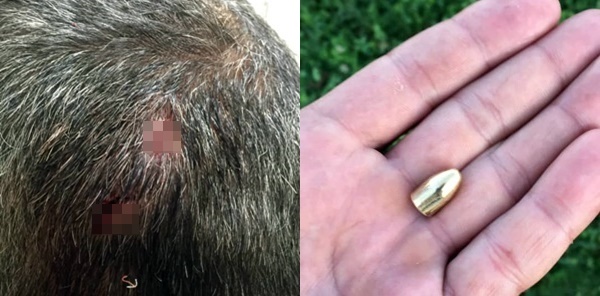 BAŞINA YORGUN MERMİ İSABET ETTİ