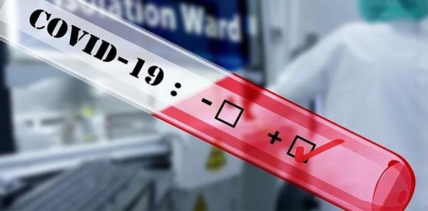 COVİD TESTİ POZİTİFTİ AMA …