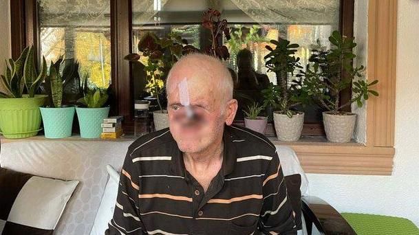 HER ŞEY BİR SİVİLCE İLE BAŞLADI!